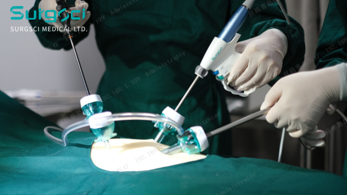 tin tức mới nhất của công ty về Nơi rạch Trocar | khoa học phẫu thuật 0