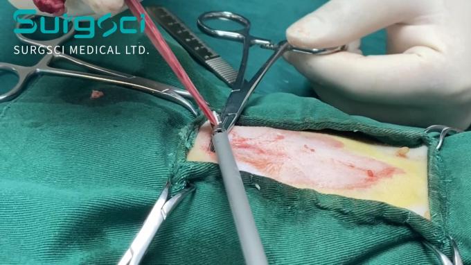 tin tức mới nhất của công ty về Dao siêu âm thú y để niêm phong và thắt tàu | khoa học phẫu thuật  0