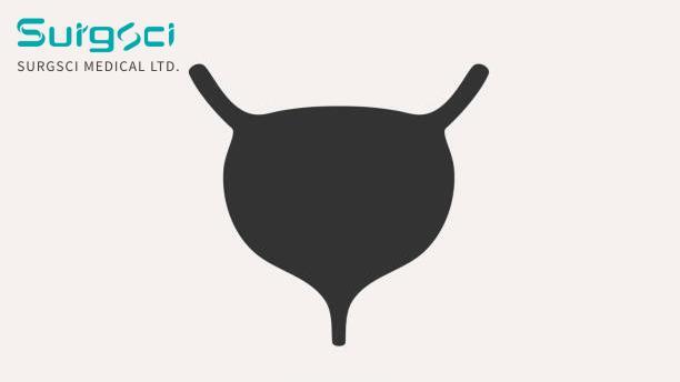 tin tức mới nhất của công ty về Phân loại lâm sàng của bệnh lao bàng quang.  0