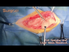 Cat Liver Mass Removal | Pet Ultrasonic Scalpel System | SurgSci
